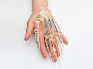 Hand and finger joint implant concept