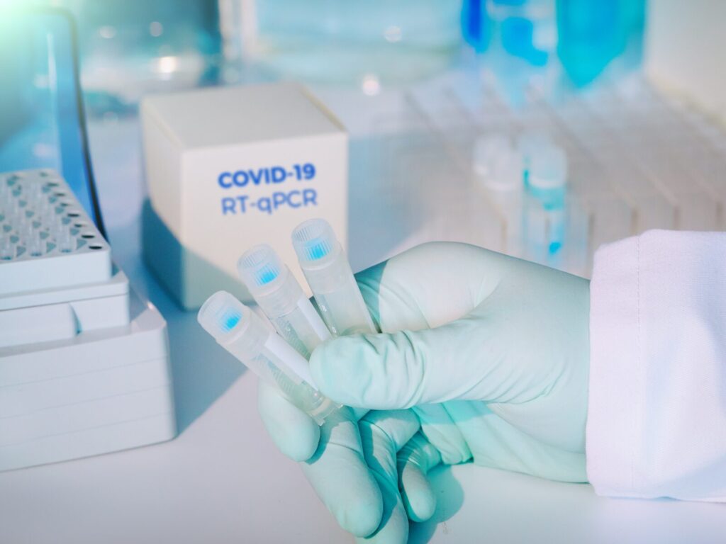 Chemist holds three samples for Covid surface testing