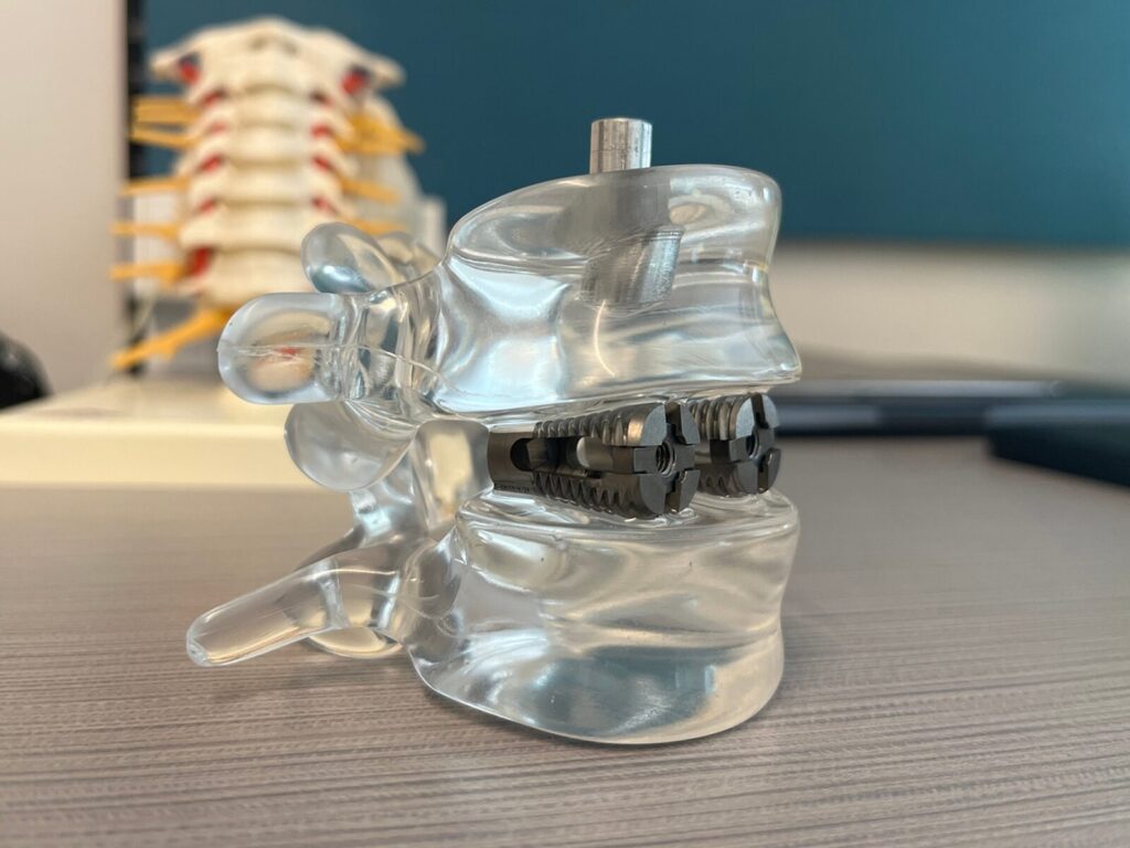 Model vertebrae with a spinal fusion device