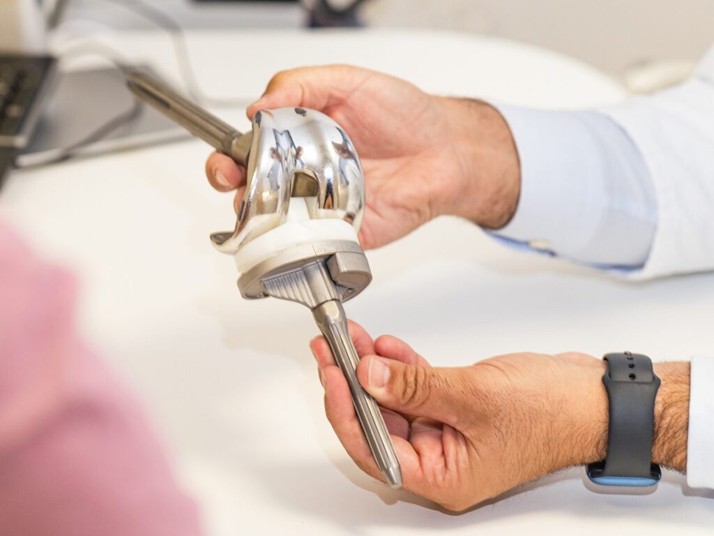 Doctor holds a prosthetic knee