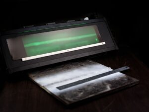 radiography
