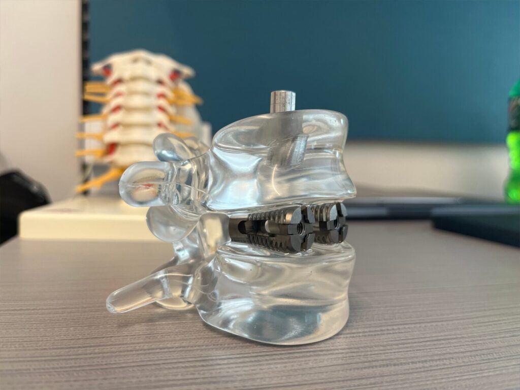 A spinal fusion device on a desk