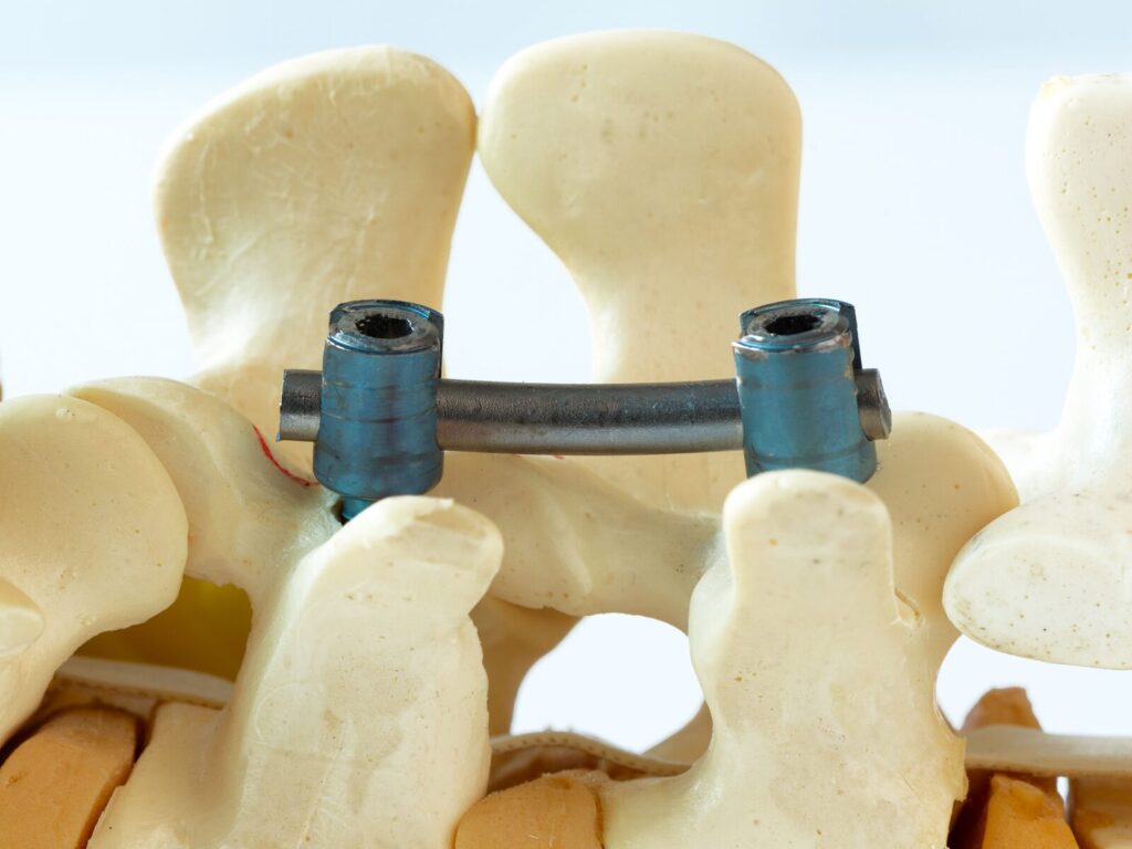 Model spine and fusion device