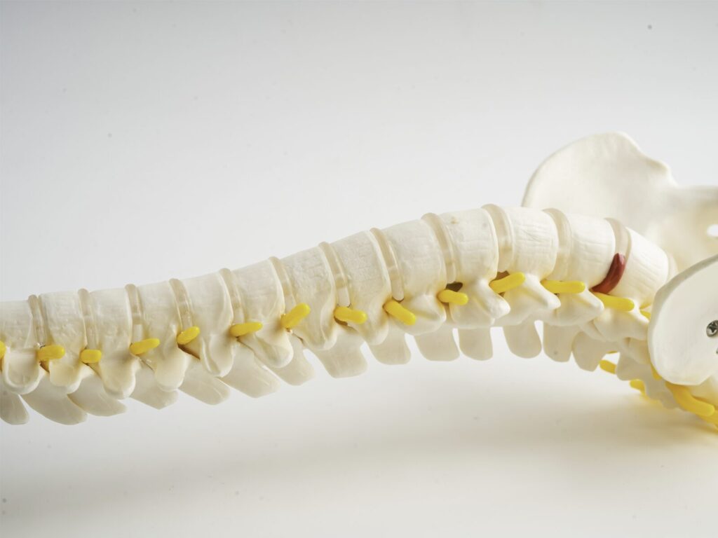 Bone discs